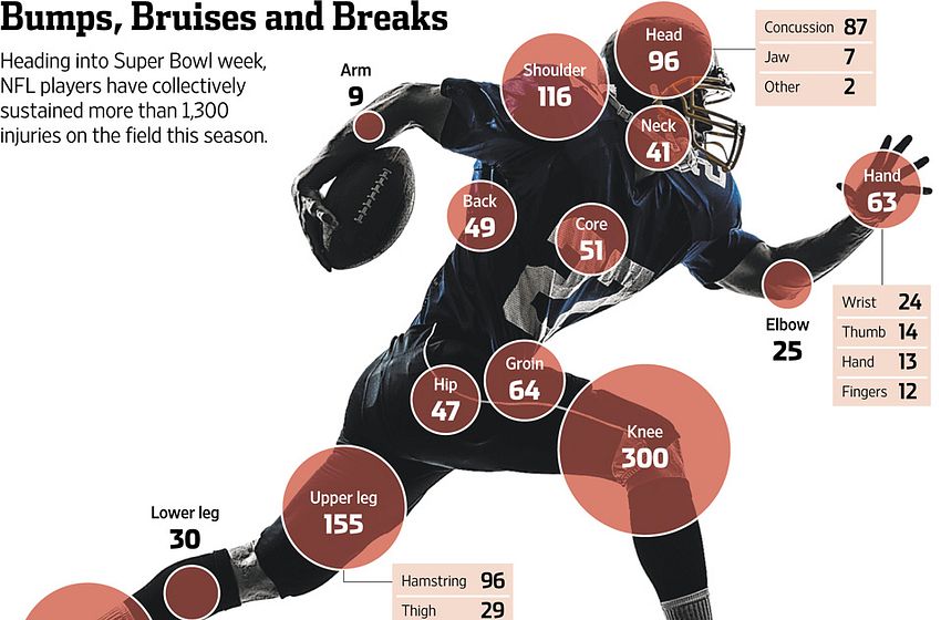 Infographic breaks down every injury in NFL in 2013 season