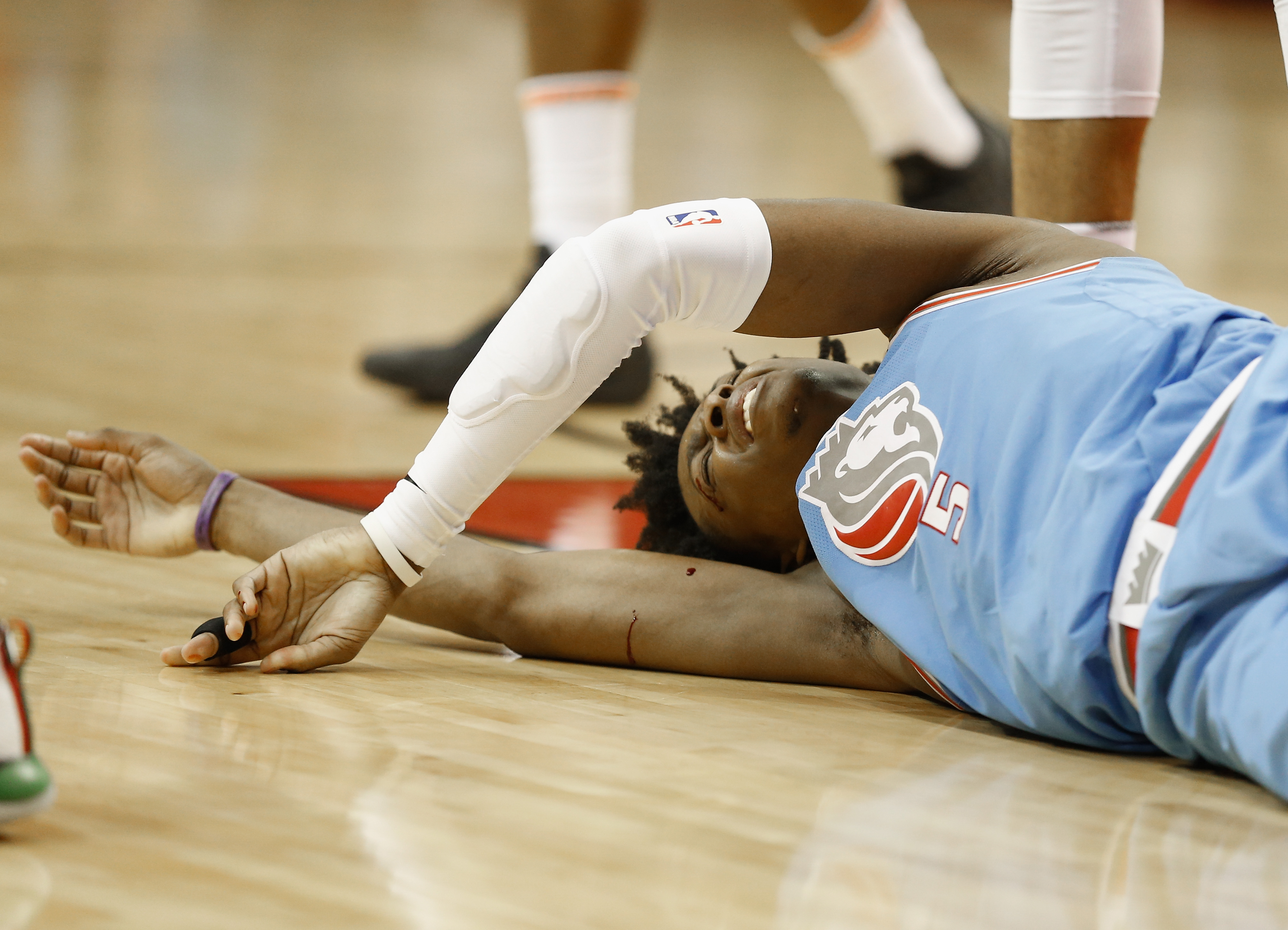 De'Aaron Fox knee injury Sacramento Kings