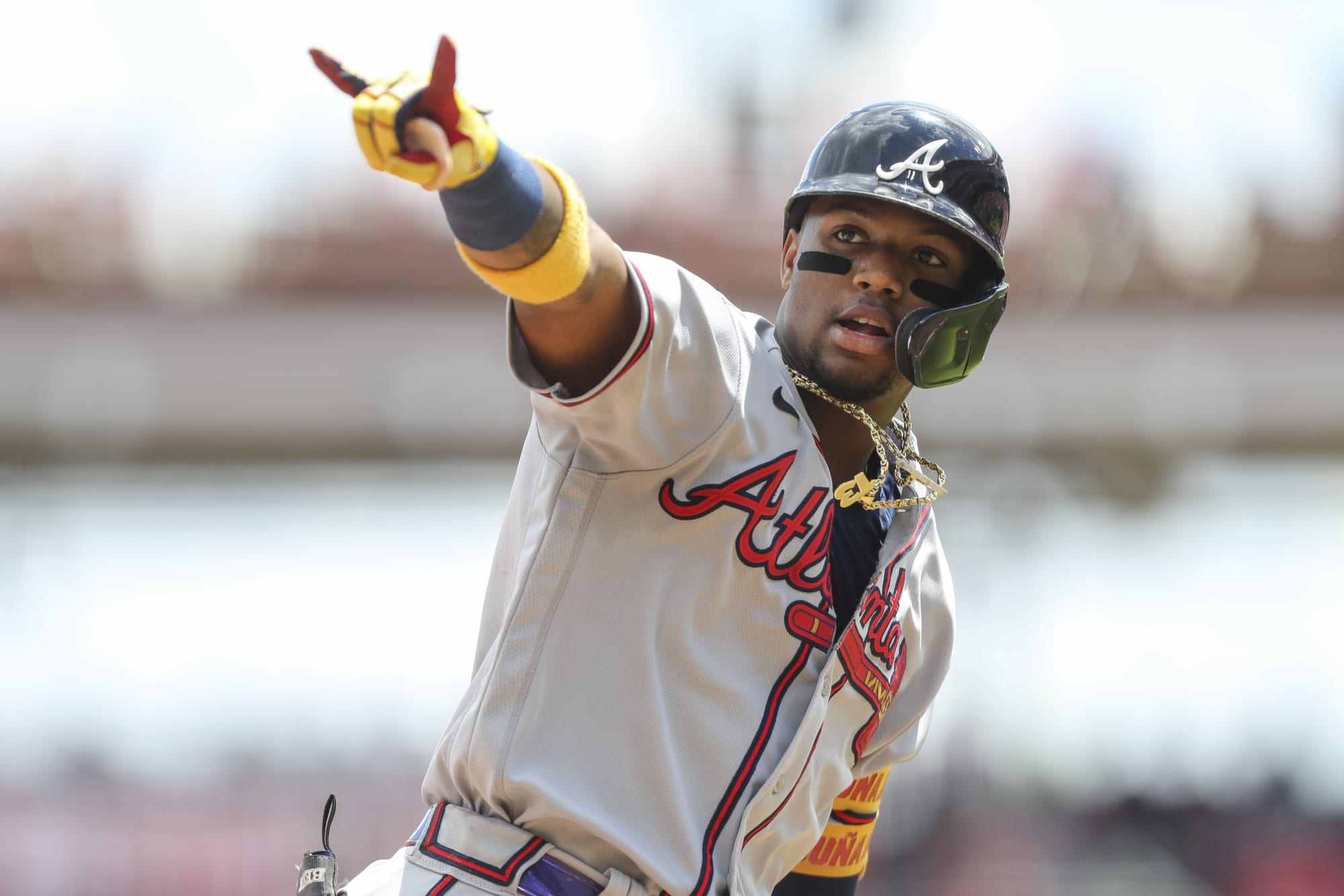 Photo of Braves: After latest injury, Ronald Acuña return really can’t wait