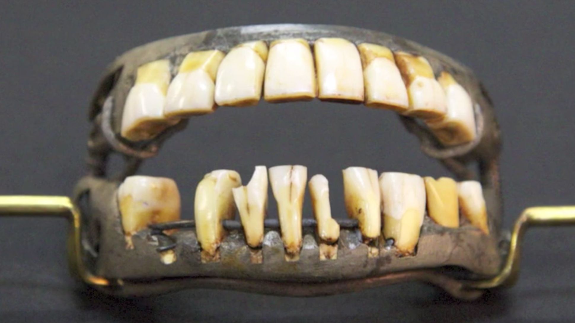 The Funky History of George Washington's Fake Teeth | Mental Floss
