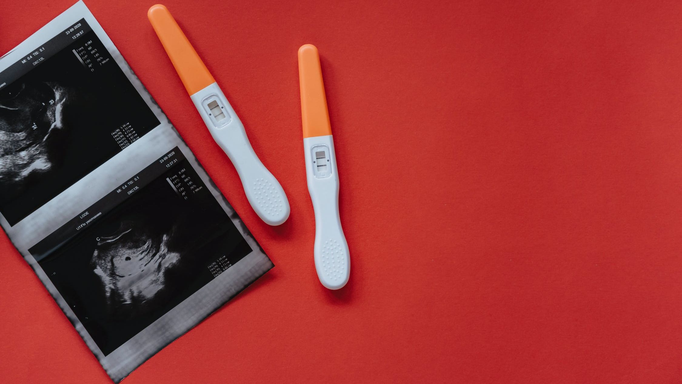 8 Historical Methods Of Detecting Pregnancy Mental Floss 8 Historical Methods Of Detecting Pregnancy Mental Floss