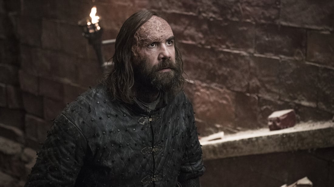 Rory McCann stars as The Hound in Game of Thrones