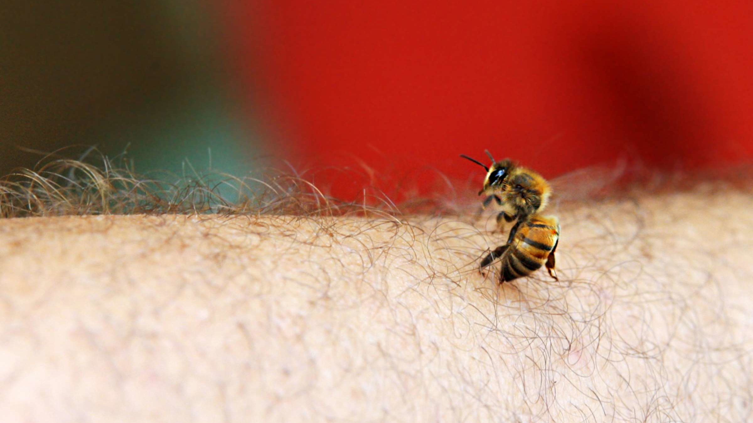 How To Treat A Bee Sting Mental Floss
