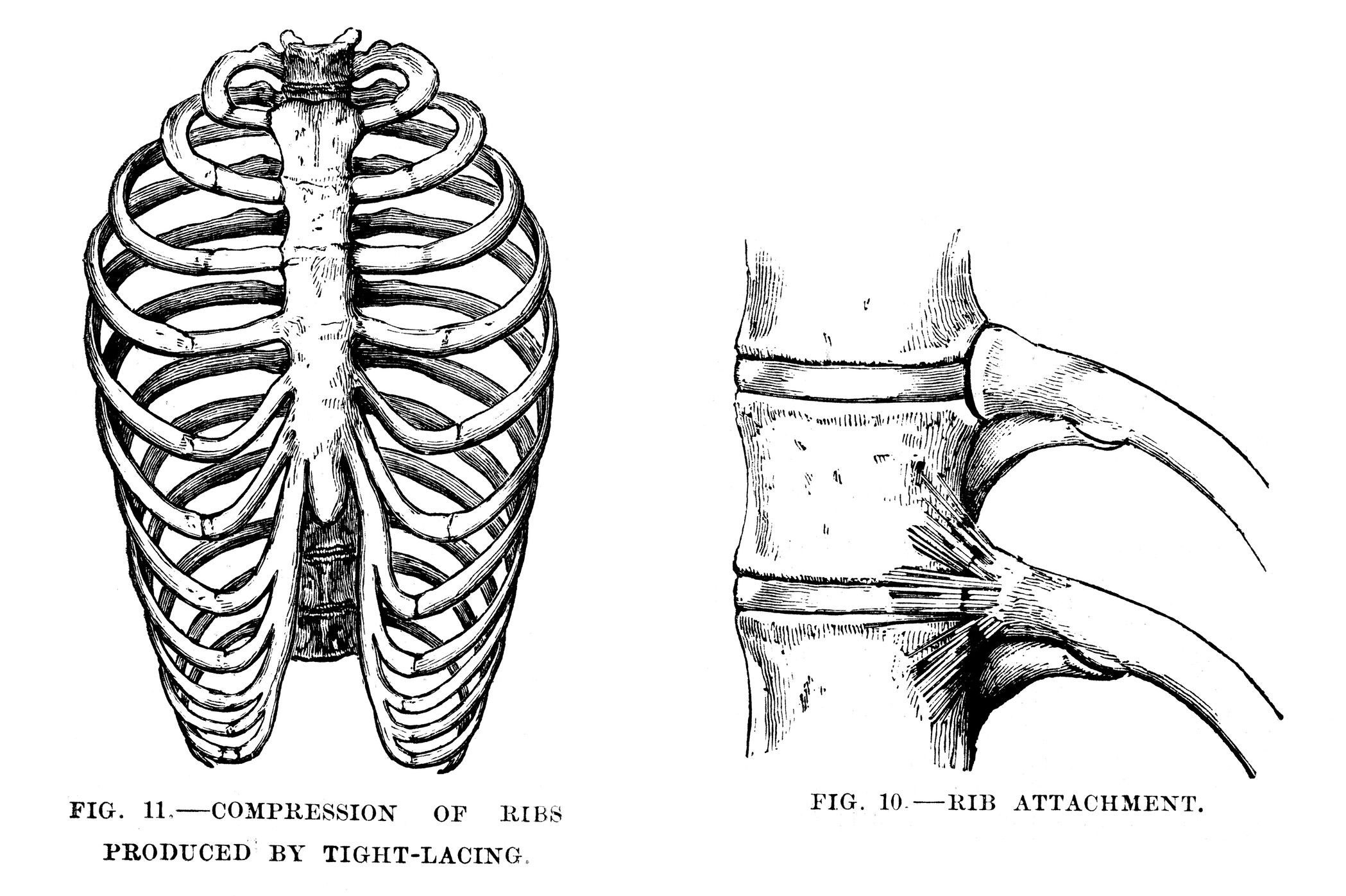 Соединение между ребрами. Скелет грудной клетки. Ребра рисунок. Рёбра человека рисунок. Ложные ребра.