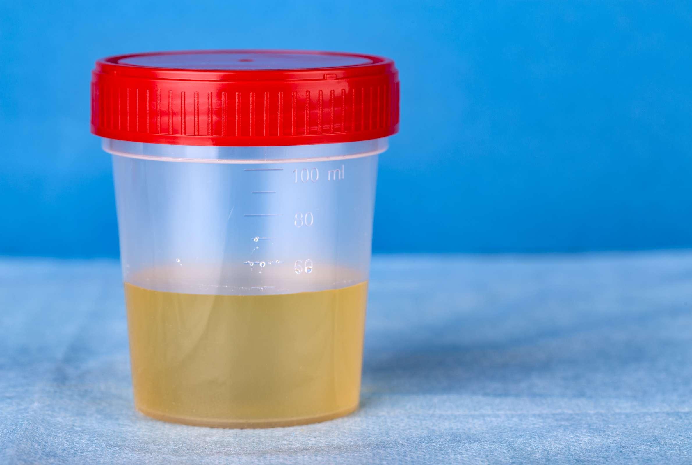 9 Fascinating Facts About Urine - Vimarsana News