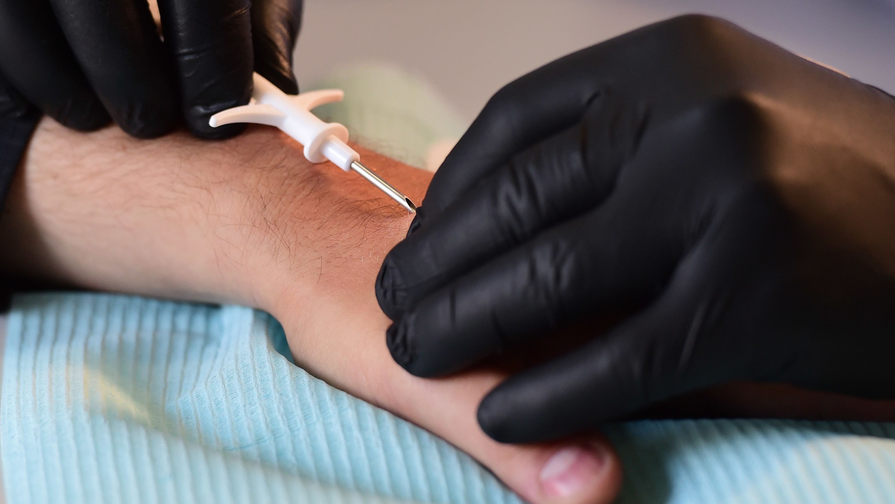 Thousands of Swedes Are Replacing Their ID Cards with Microchip Implants Mental Floss