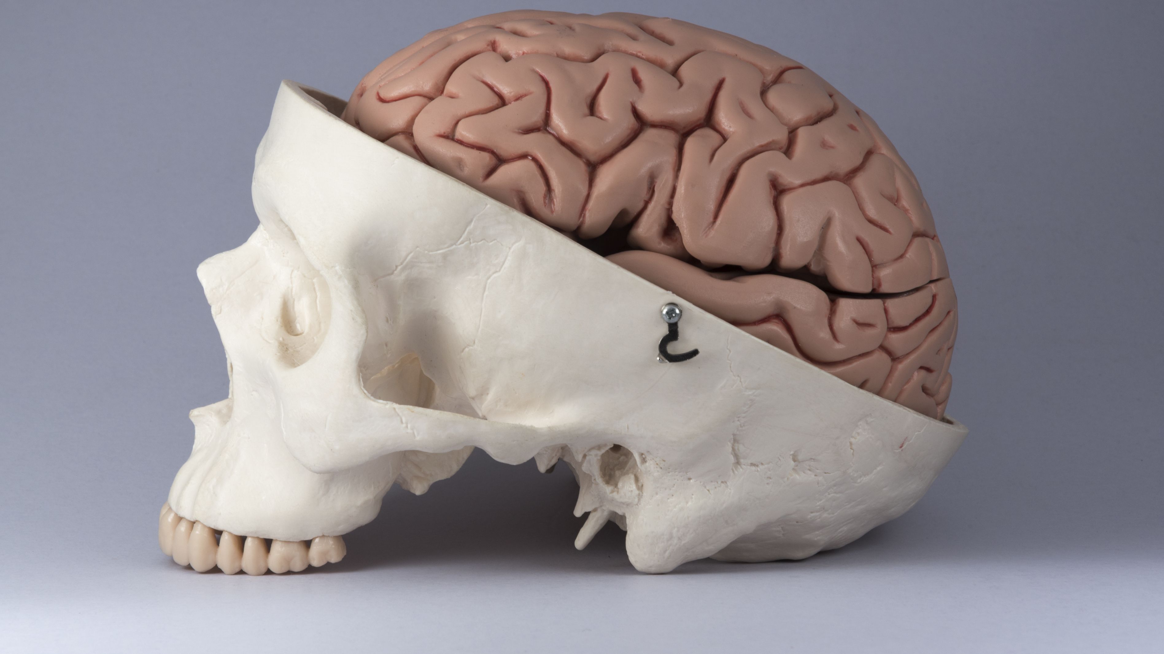 brain skull disease between medical mental harvard
