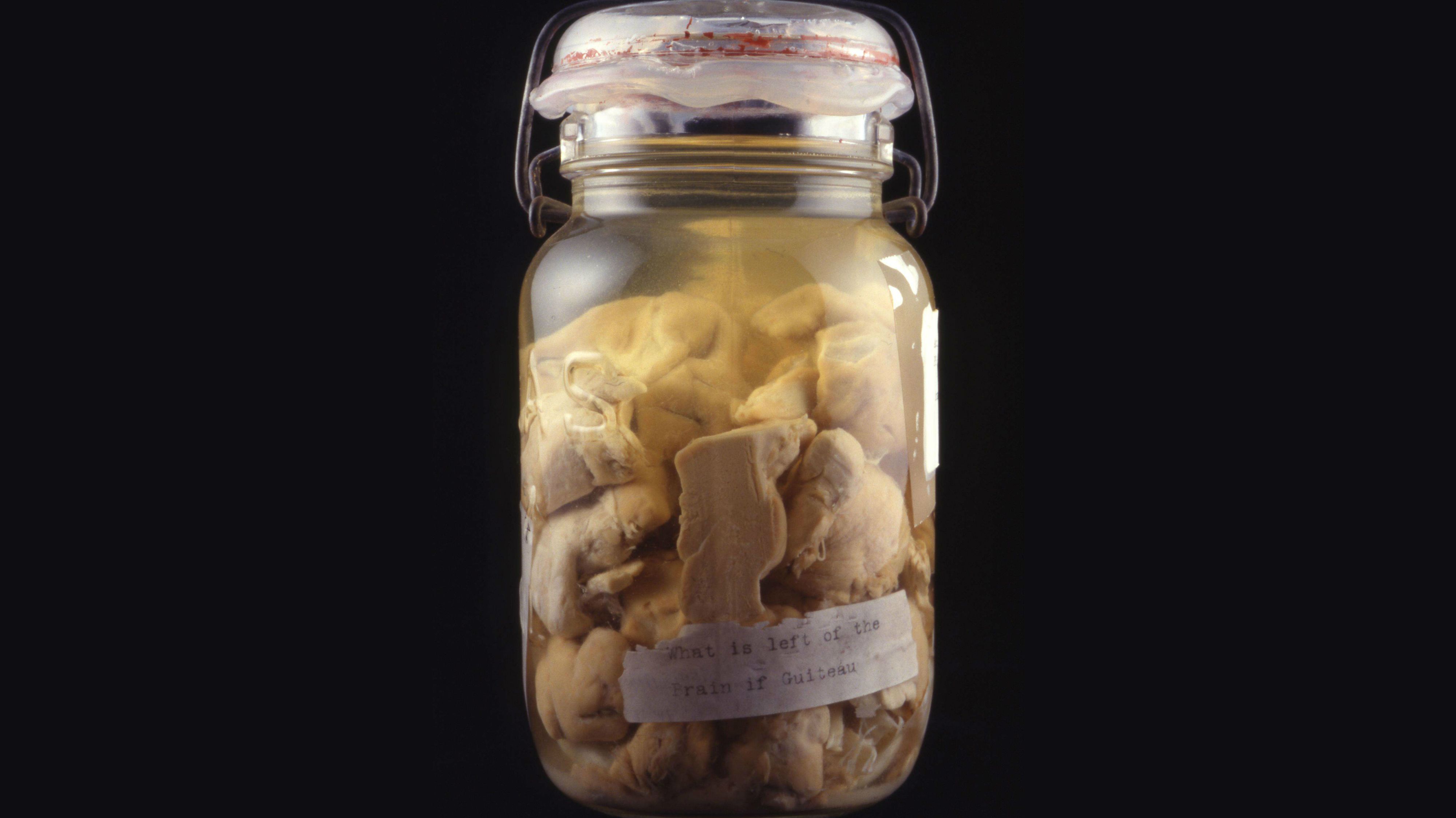 This Is the Brain of the Man Who Shot James A. Garfield Mental Floss