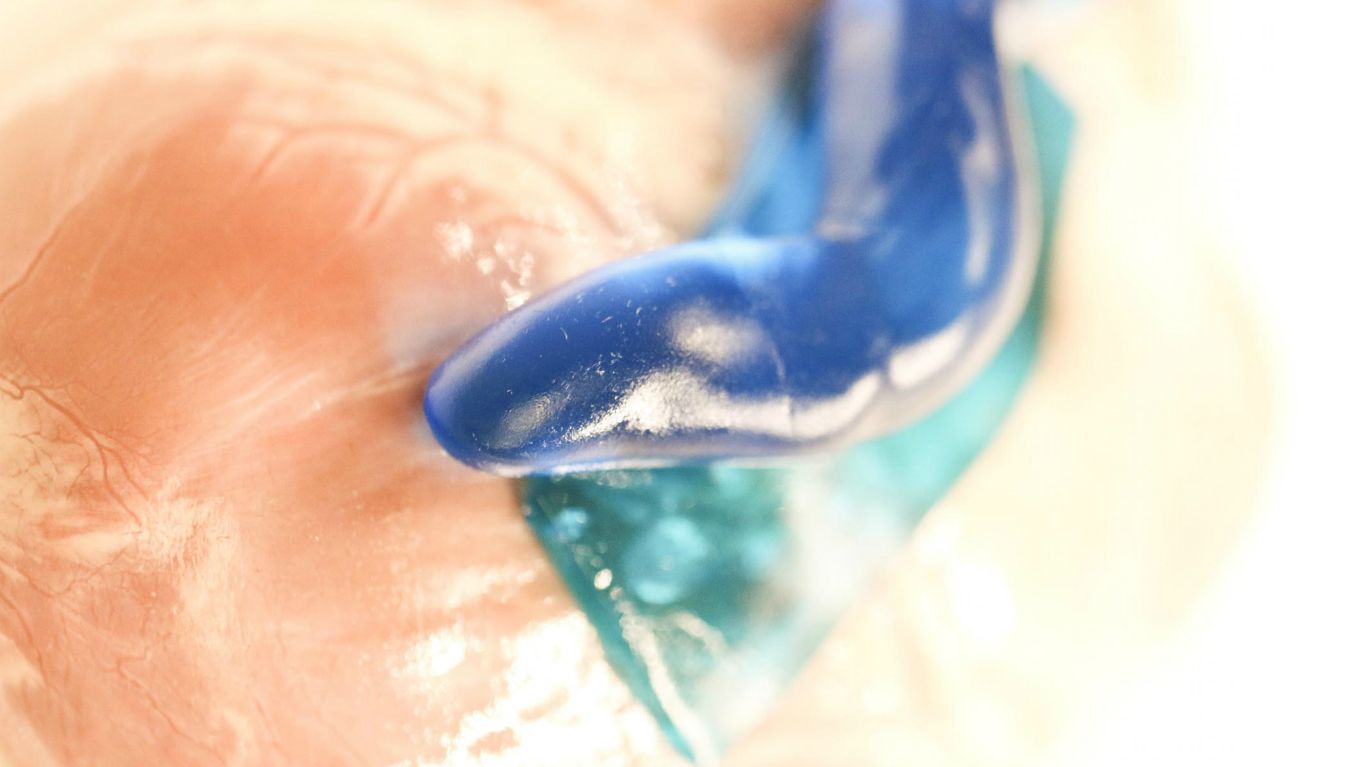 Slug Slime Inspires SuperSticky Surgical Sealant Mental Floss