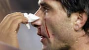 Abbondanzieri sangra luego del arañazo de Marcelo Gallardo