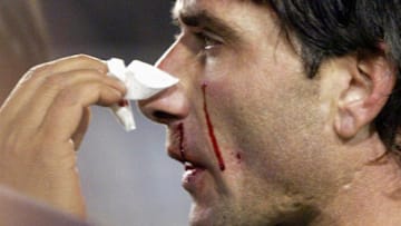 Abbondanzieri sangra luego del arañazo de Marcelo Gallardo