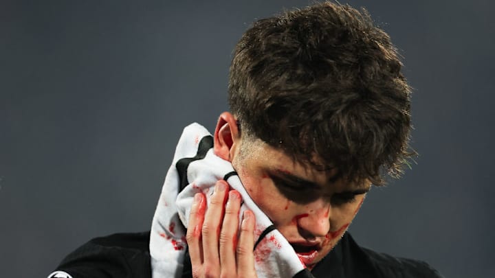 Pau Cubarsí took a boot to the face in Barcelona's Champions League fixture against Crvena zvezda. Pau Cubarsí took a boot to the face in Barcelona's Champions League fixture against Crvena zvezda.
