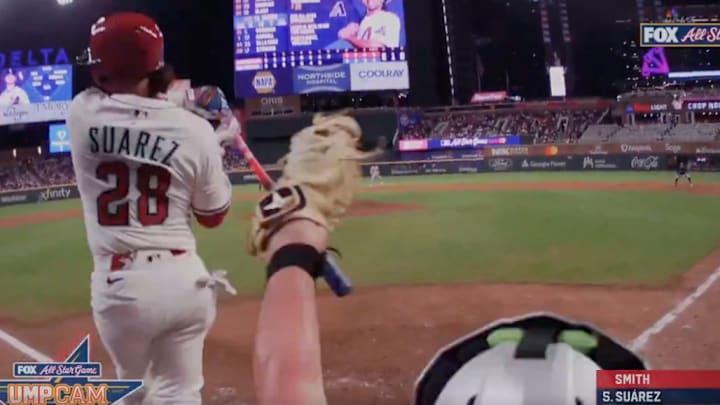 Arizona's Eugenio Suárez was hit in the hand by a pitch in the MLB All-Star Game.