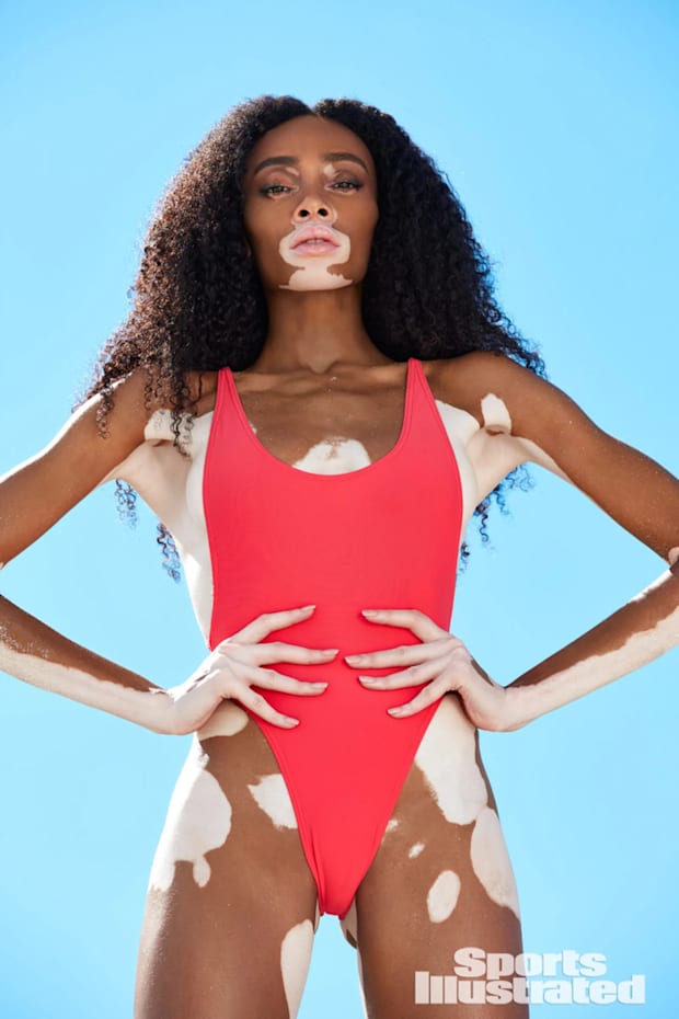 Winnie Harlow