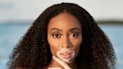 Winnie Harlow was photographed by Laretta Houston in Great Exuma, Bahamas. 