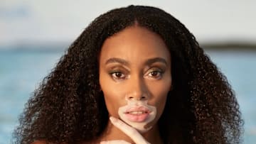 Winnie Harlow was photographed by Laretta Houston in Great Exuma, Bahamas. 