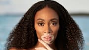 Winnie Harlow was photographed by Laretta Houston in Great Exuma, Bahamas. 