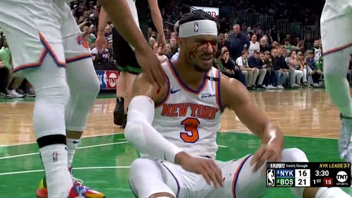 New York Knicks guard Josh Hart bleeds after taking an elbow to the face from Boston Celtics center Luke Kornet. New York Knicks guard Josh Hart bleeds after taking an elbow to the face from Boston Celtics center Luke Kornet.