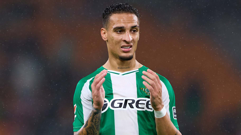 Antony looking bemused.