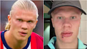 Haaland suffered a nasty facial injury on Norway’s team bus