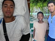 Jude Bellingham recently underwent surgery on his right shoulder.