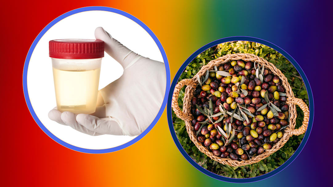 Images of urine, olives