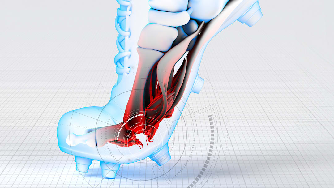 The origin of the term ‘turf toe’ dates back nearly 50 years.