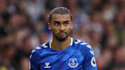 Calvert-Lewin's return has been set back 