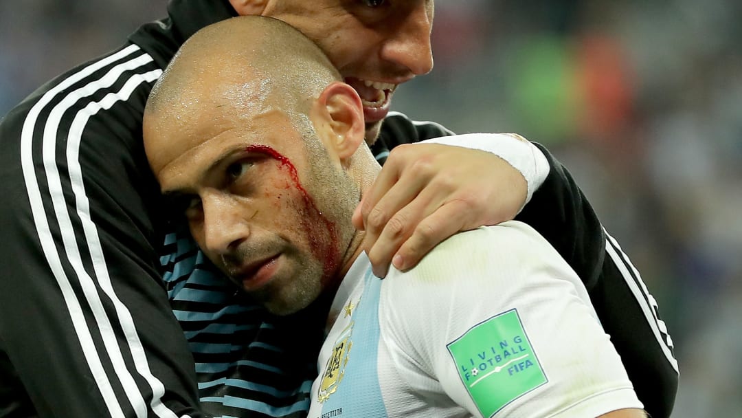 Así quedó Mascherano de tanto que le hablaron de sus finales perdidas. Así quedó Mascherano de tanto que le hablaron de sus finales perdidas.