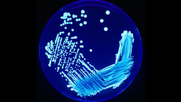 Legionella in a Petri dish under UV light.