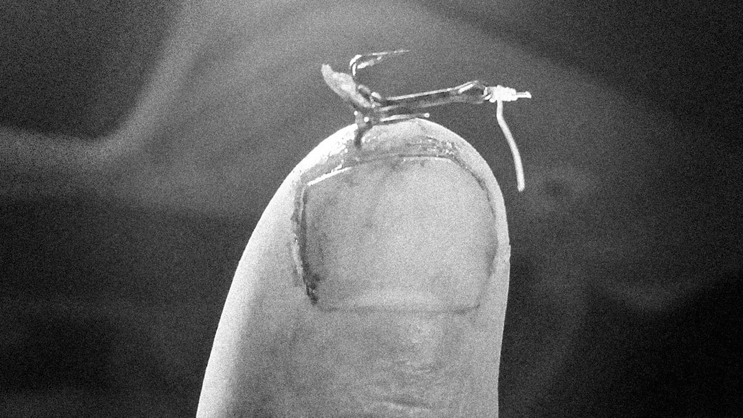 Five miles from the truck, after dark, with a limit of walleyes — and a treble hook I didn’t plan on bringing home. Five miles from the truck, after dark, with a limit of walleyes — and a treble hook I didn’t plan on bringing home.