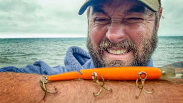 Ouch! Getting hooked isn't a fun experience, but with a little planning, you can remove a hook from your body without a doctor visit.