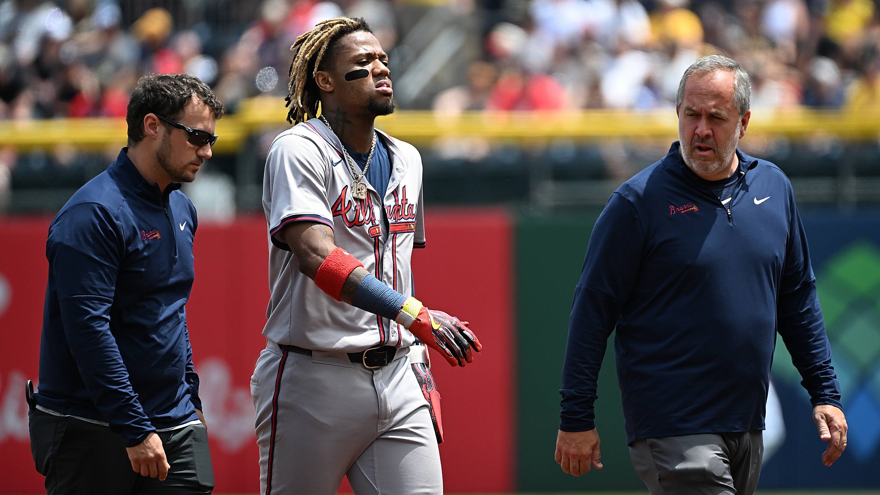 Ronald Acuña Jr.'s frightening injury is why the Braves always come with a catch