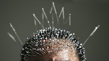 Chinese Guinness World Record Holder Inserts 1,200 Needles Into Head