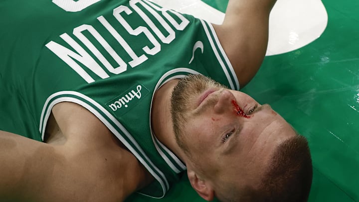 Apr 4, 2025; Boston, Massachusetts, USA; Boston Celtics center Kristaps Porzingis (8) lies on the floor after being cut by an elbow to the nose by Phoenix Suns forward Cody Martin (17) during the second half at TD Garden. Mandatory Credit: Winslow Townson-Imagn Images