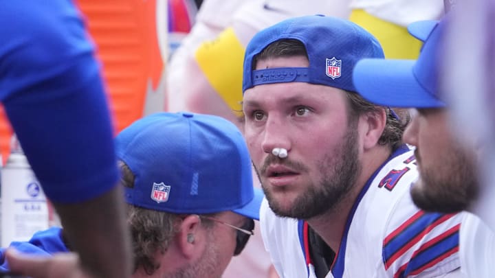 Josh Allen left Sunday's game with a gruesome nosebleed.