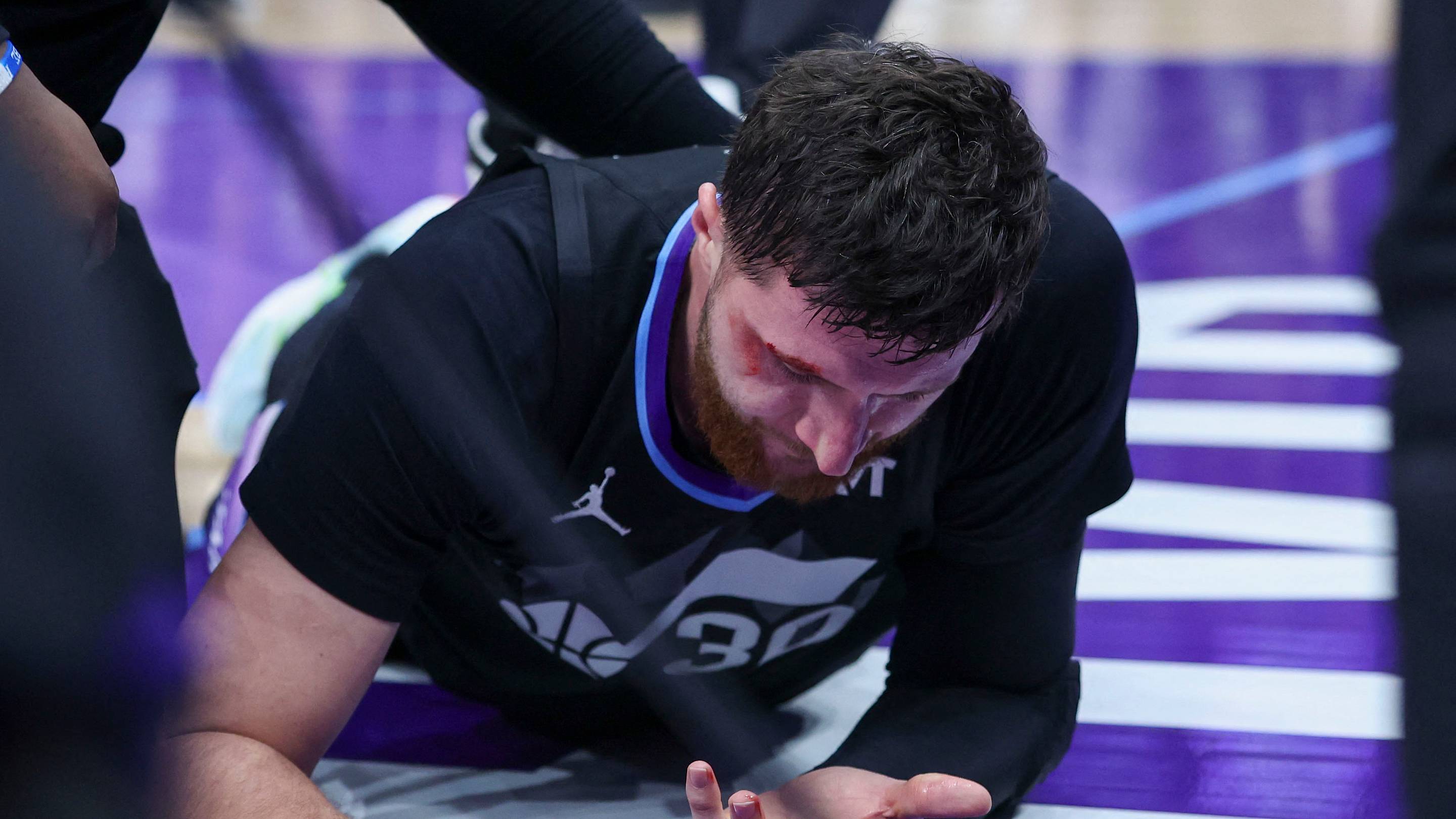 Jusuf Nurkic injury gives Jazz a problem that doesn’t have an easy answer