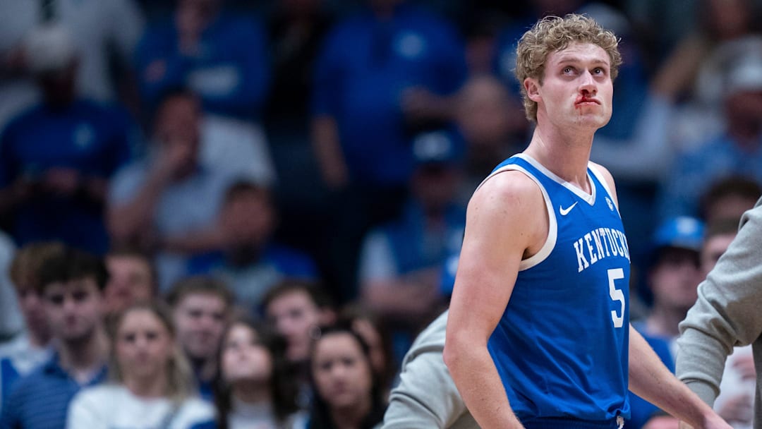 Kentucky guard Collin Chandler (5) leaves the court with a bloody nose against Florida during their quarterfinal game of the 2026 SEC Men’s Basketball Tournament at Bridgestone Arena in Nashville, Tenn., Friday, March 13, 2026.