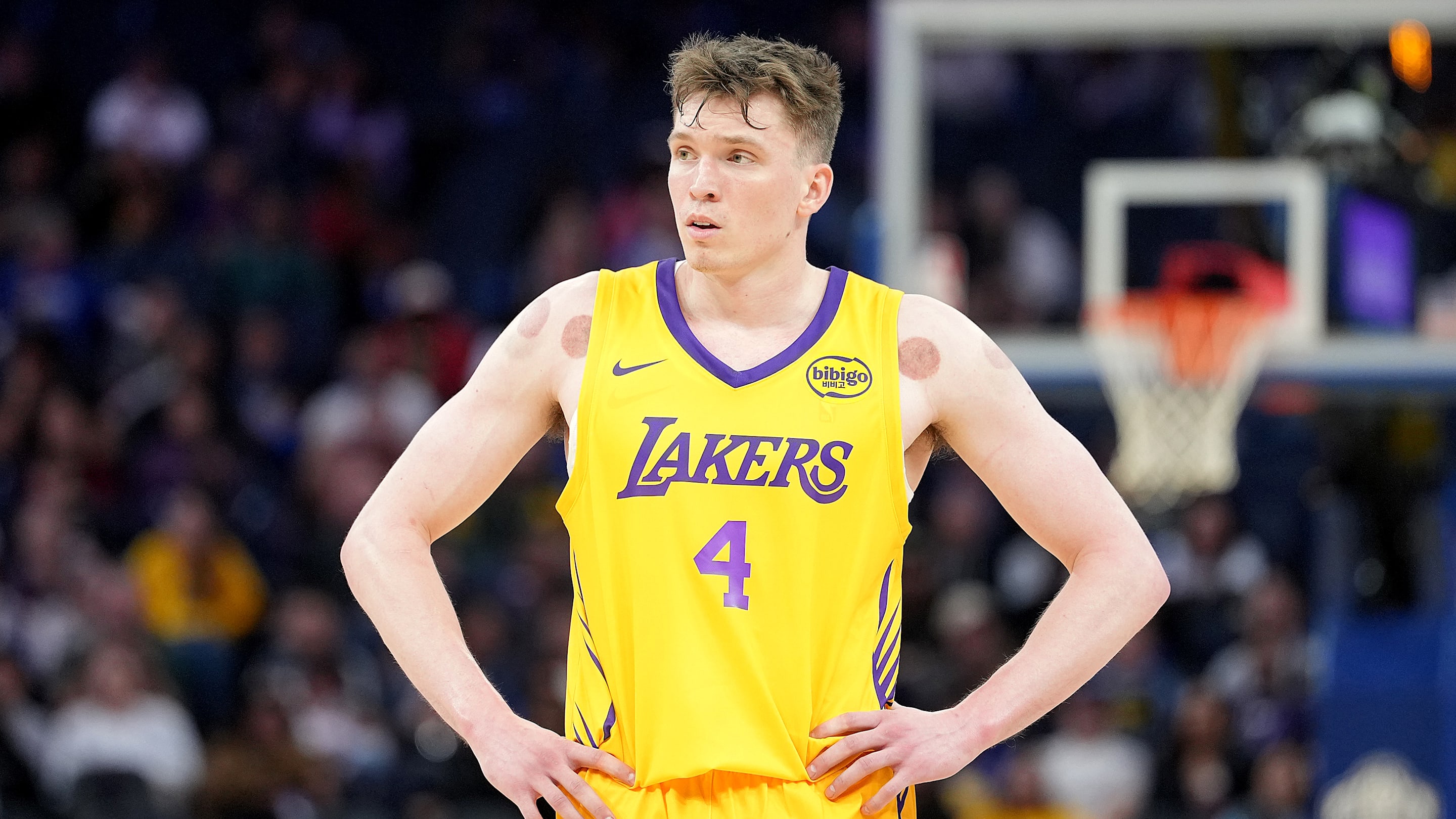 Painful Dalton Knecht reality Lakers fans must accept
