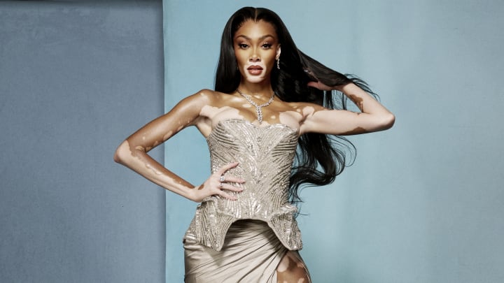 Winnie Harlow was photographed by Yu Tsai in Legends Hollywood, Fla.