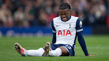Destiny Udogie is the latest Tottenham injury concern