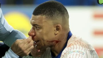 Kylian Mbappe hat sich die Nase gebrochen