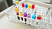 Blood test for clinical trial,Charing Cross Hospital