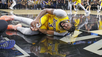 Anthony Davis tiene molestias en la rodilla