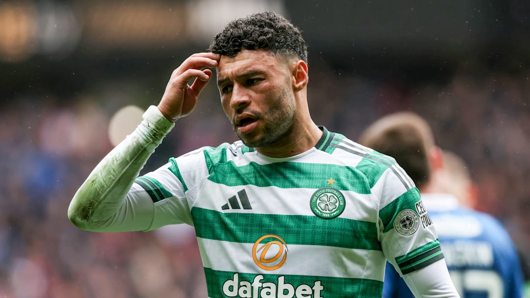 Alex Oxlade-Chamberlain symbolizes Celtic's lack of ambition.