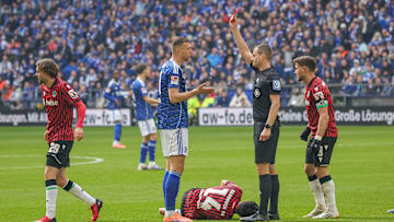 Edin Dzeko sah von Schiedsrichter Robin Braun Rot