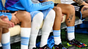 Fußballer neigen häufig zu O-Beinen