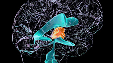 The pineal gland is located in the center of the brain.