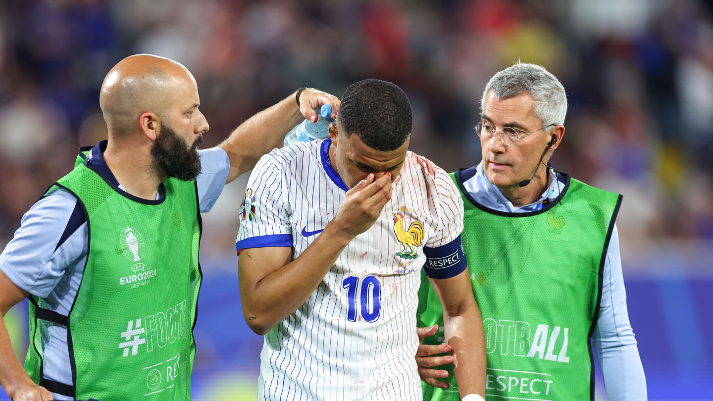 Schlimme Bilder: Kylian Mbappe bricht sich gegen Österreich die Nase