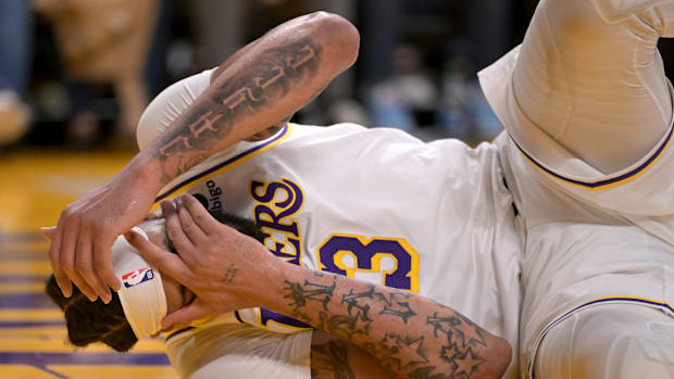 Apr 7, 2024; Los Angeles, California, USA;  Los Angeles Lakers forward Anthony Davis (3) covers his